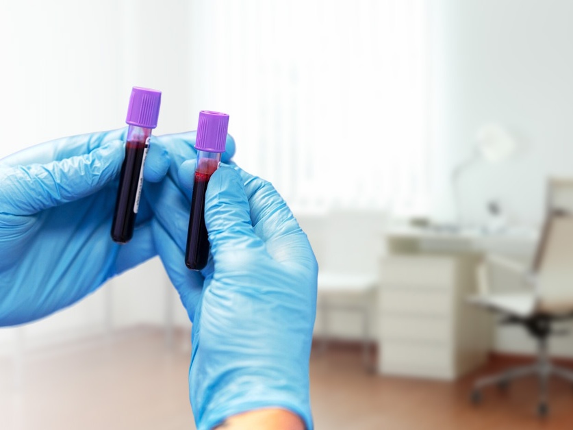 SPADIA - odběrové místo Poliklinika Centrum zdraví Milovice